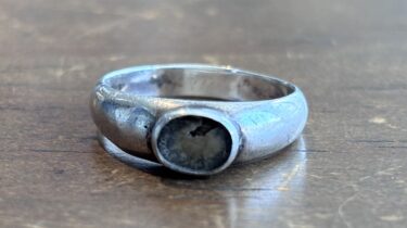 Ring-stone-removal-repair-